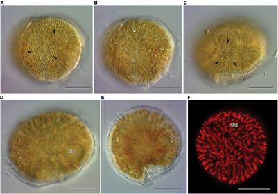 Global Mass Spectrometric Analysis Reveals Chemical Diversity of Secondary Metabolites and 44-Methylgambierone Production in Philippine Gambierdiscus Strains